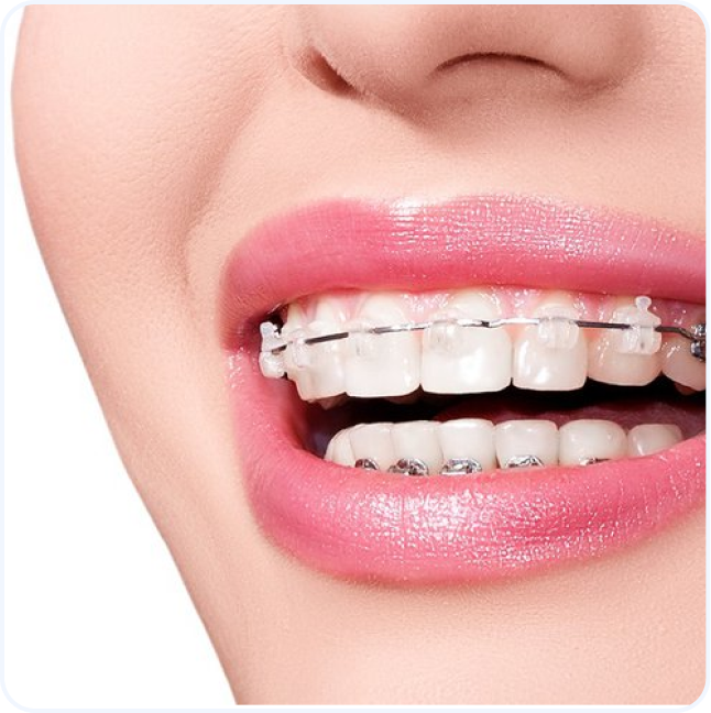 Triển khai mô hình kiểm tra sức khỏe răng miệng cho trẻ sơ sinh