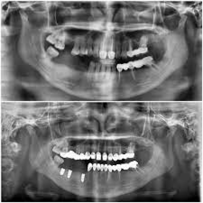 Triển khai mô hình kiểm tra sức khỏe răng miệng cho trẻ sơ sinh
