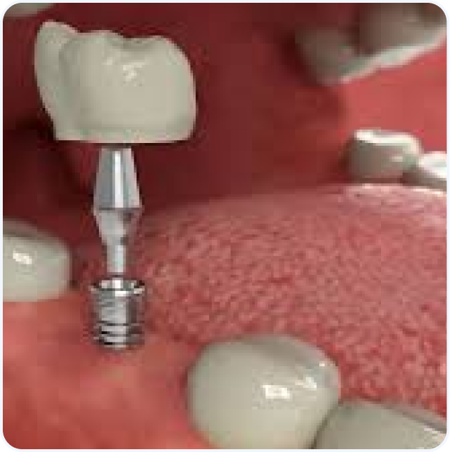 Triển khai mô hình kiểm tra sức khỏe răng miệng cho trẻ sơ sinh